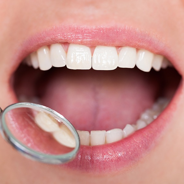 Dental Hygiene and Teeth Cleanings | Kingsland Family Dental Centre | SW Calgary | General Dentist