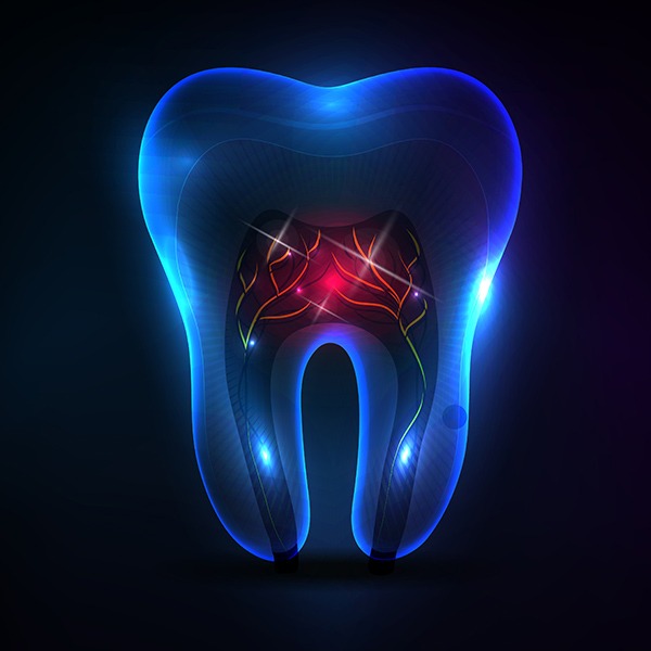 Root Canal Therapy | Kingsland Family Dental Centre | SW Calgary | General Dentist