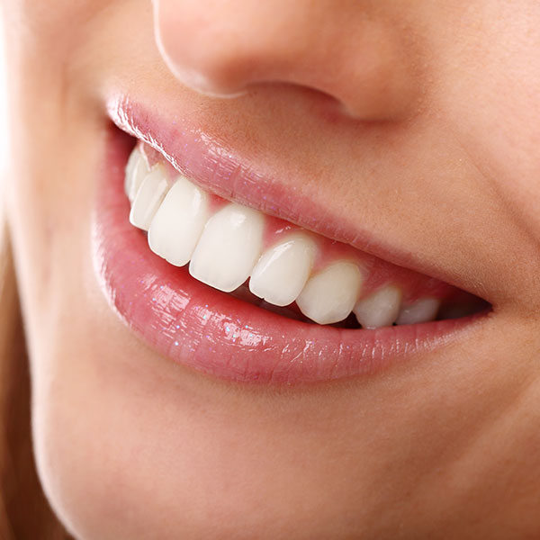 Teeth Whitening | Kingsland Family Dental Centre | SW Calgary | General Dentist